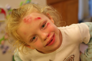 Face plant July 2007 011